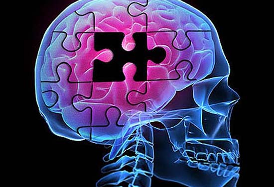 UNDERSTANDING AND MANAGING ALZHEIMER’S