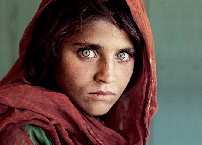 Bengaluru provides free of cost treatment to Sharbat Gula