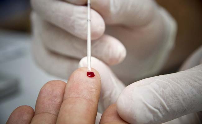 Blood test to diagnose skin cancer