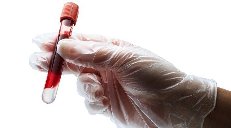 Blood test to diagnose skin cancer