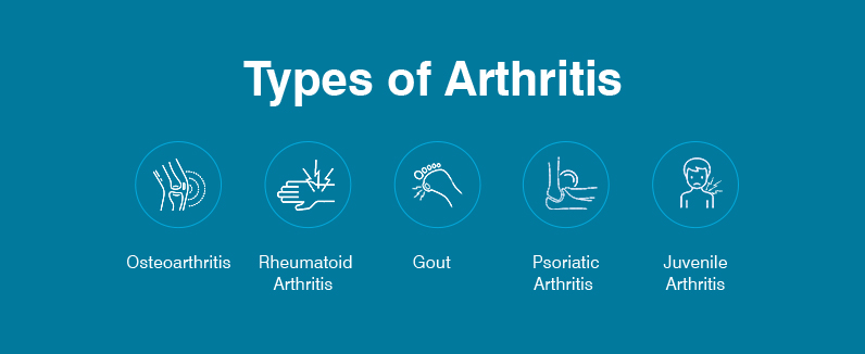 Arthritis Treatments