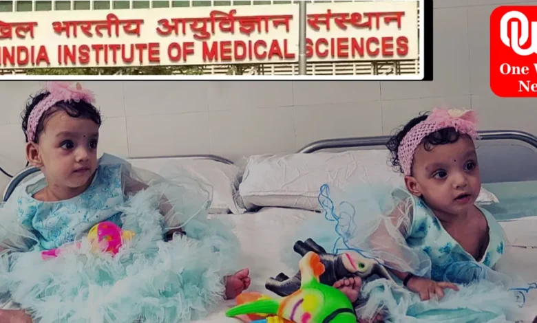 Uttar Pradesh Bareilly’s 1-year-old two conjoined girls separated after 12-hr surgery at AIIMS