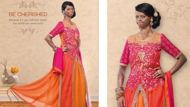 Change is beautiful: Acid attack survivor becomes face of Viva and Diva!