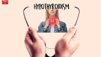 Hypothyroidism