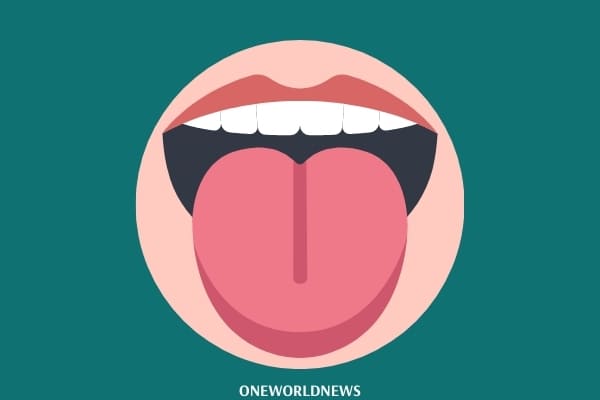 Tongue