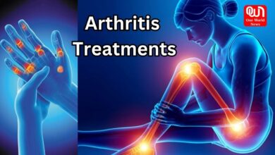 Arthritis Treatment