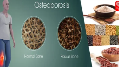 Osteoporosis nutrition 8 amazing nutrients for strong bones