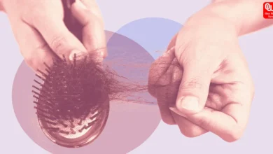 Hair loss