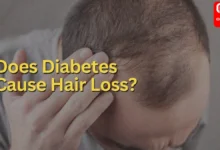 diabetes hair loss