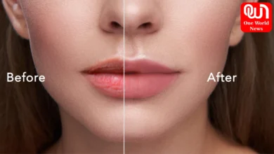 how to remove wrinkles from lips