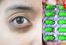 how to use vitamin e capsule for dark circles