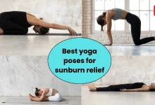 yoga poses for sunburn