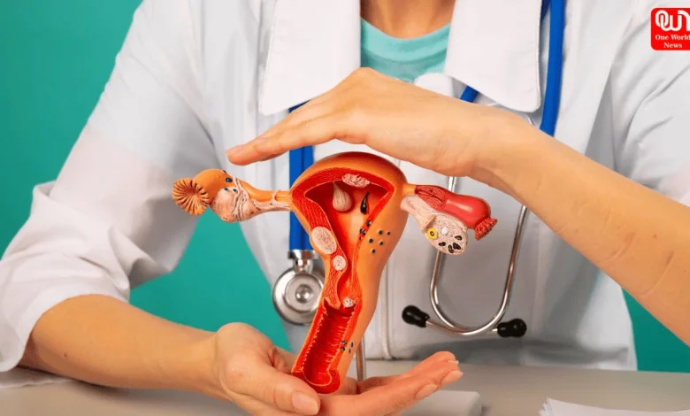 Ovarian Cancer