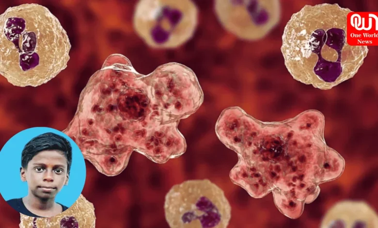 amoebic meningoencephalitis