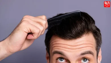 Transplanted Hair