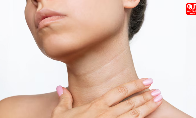 Neck Wrinkles