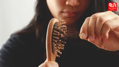 Hair loss