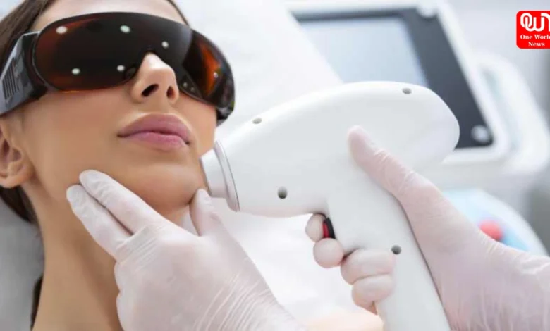 Laser Hair Removal