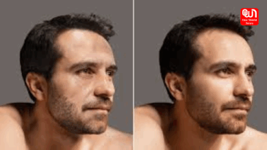 Skincare for men