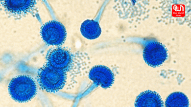 aspergillus fumigatus