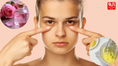 Dark Circles
