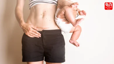 Postpartum Recovery