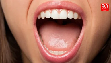 Tongue Bleeds