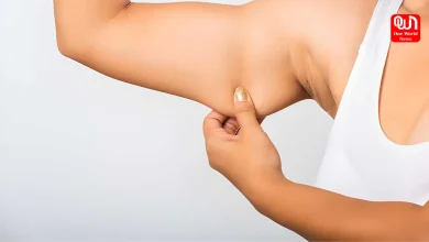 Arm Fat, Arm Excess