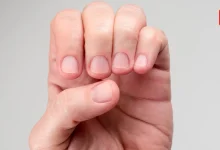 Short Nail Beds