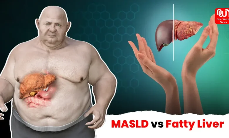 MASLD vs Fatty Liver