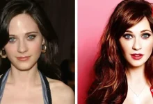 Zooey Deschanel Plastic Surgery