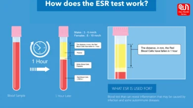 ESR Test