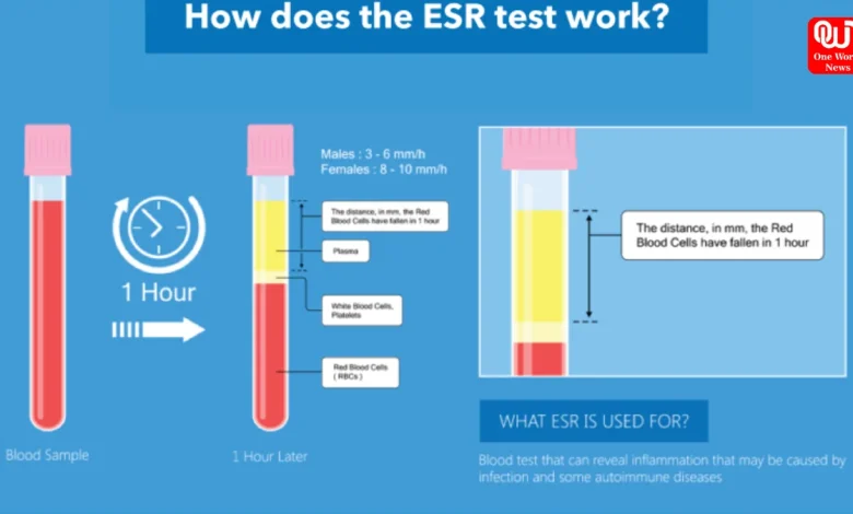 ESR Test