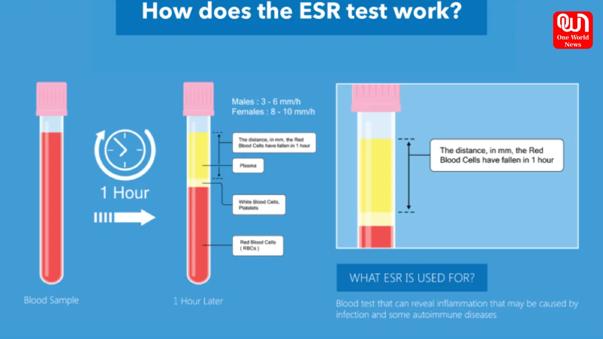 ESR Test