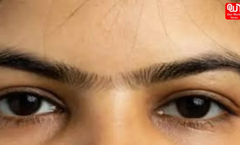 Unibrows