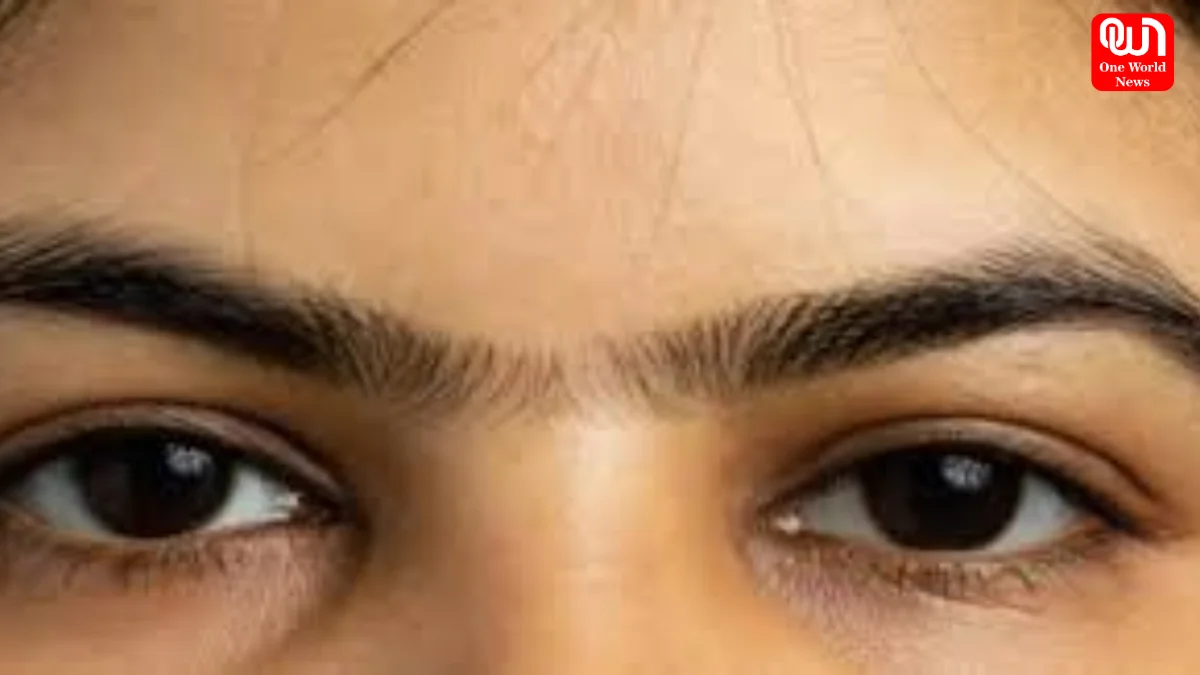Unibrows