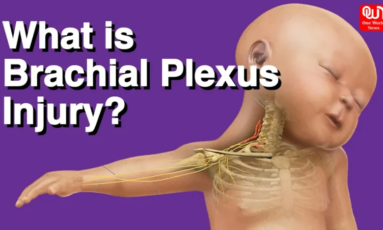 Brachial Plexus Birth Injuries