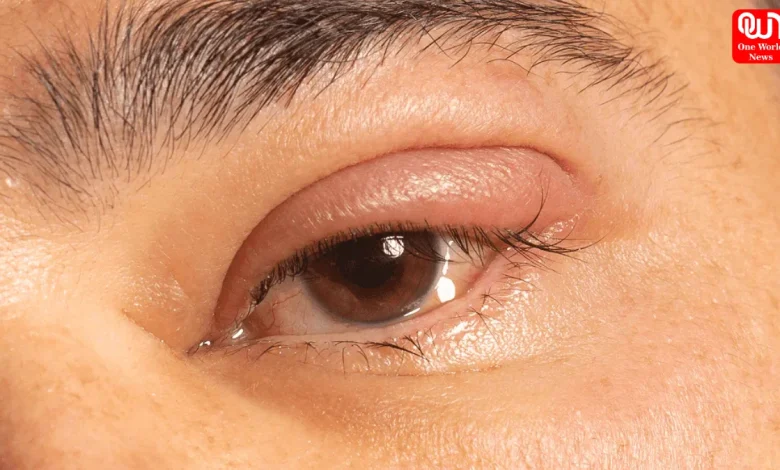 Rid Of Puffy Eyes After Crying