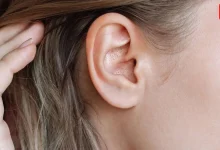 pimple in ear remedy