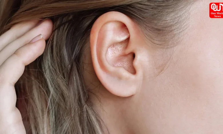 pimple in ear remedy