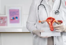 Gut Health and Women Hormones, PCOS, Endometriosis