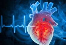 AHA acc cholesterol guidelines 2026