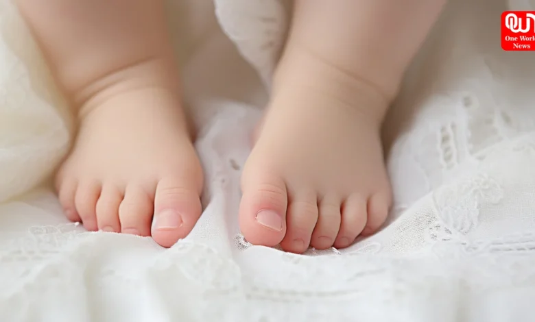 Clubfoot in Newborns