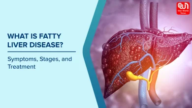 Fatty Liver