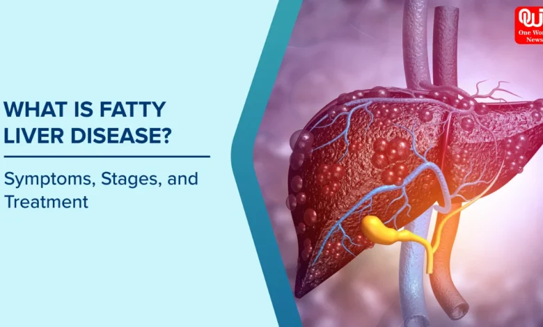 Fatty Liver