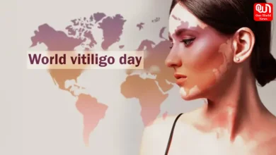 World Vitiligo Day