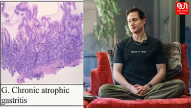 Autoimmune Gastritis Diagnosis