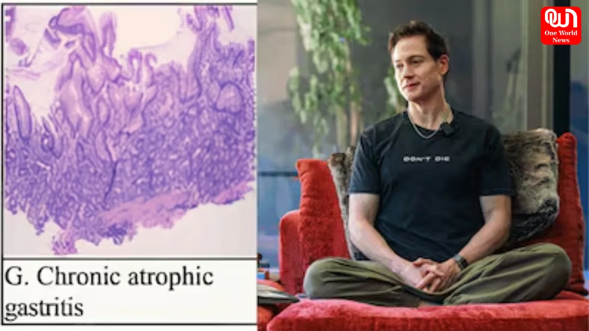 Autoimmune Gastritis Diagnosis