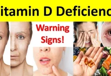 Vitamin D Deficiency Symptoms in Women