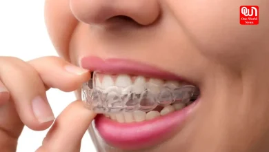 Aligners